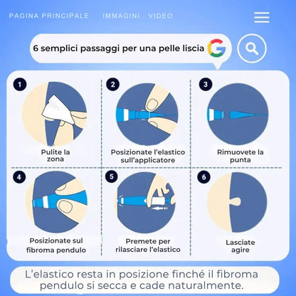 ClearTouch® | Kit completo per rimuovere fibromi cutanei senza dolore