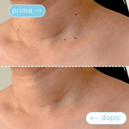 ClearTouch® | Kit completo per rimuovere fibromi cutanei senza dolore