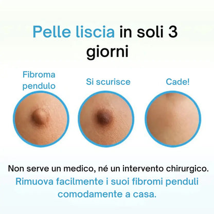 ClearTouch® | Kit completo per rimuovere fibromi cutanei senza dolore