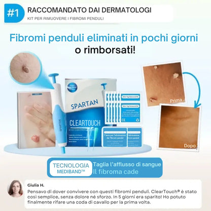 ClearTouch® | Kit completo per rimuovere fibromi cutanei senza dolore